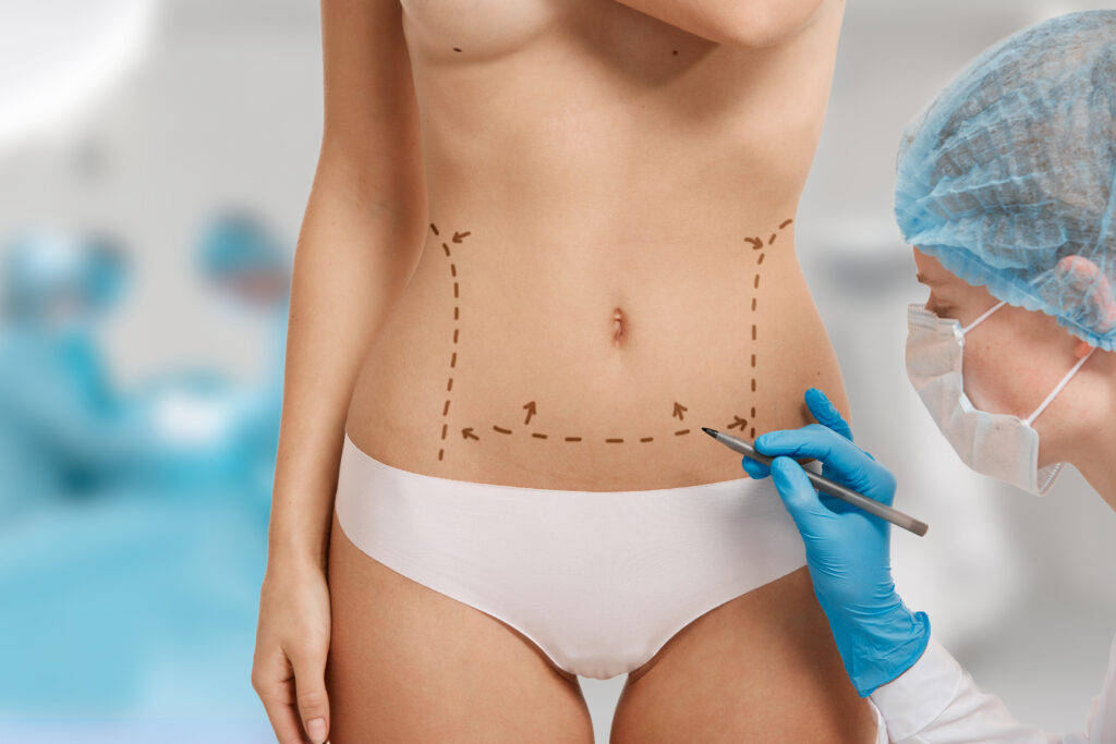 Eligere – Best Tummy Tuck Surgery Hospital in Bangalore