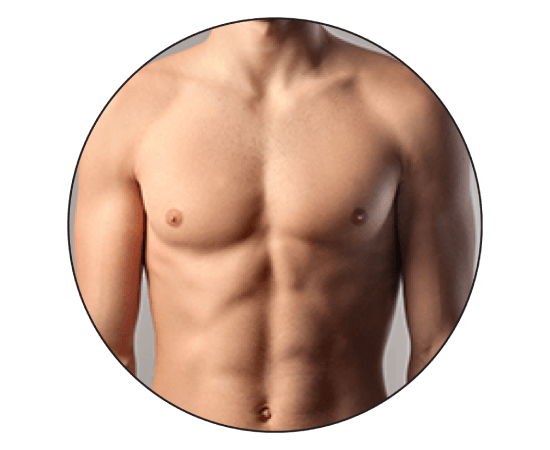 Best Gynecomastia Surgery Hospital in Bangalore – Male Chest Reduction Treatment