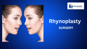 BEST RHYNOPLASTY SURGERY HOSPITAL IN BANGLORE