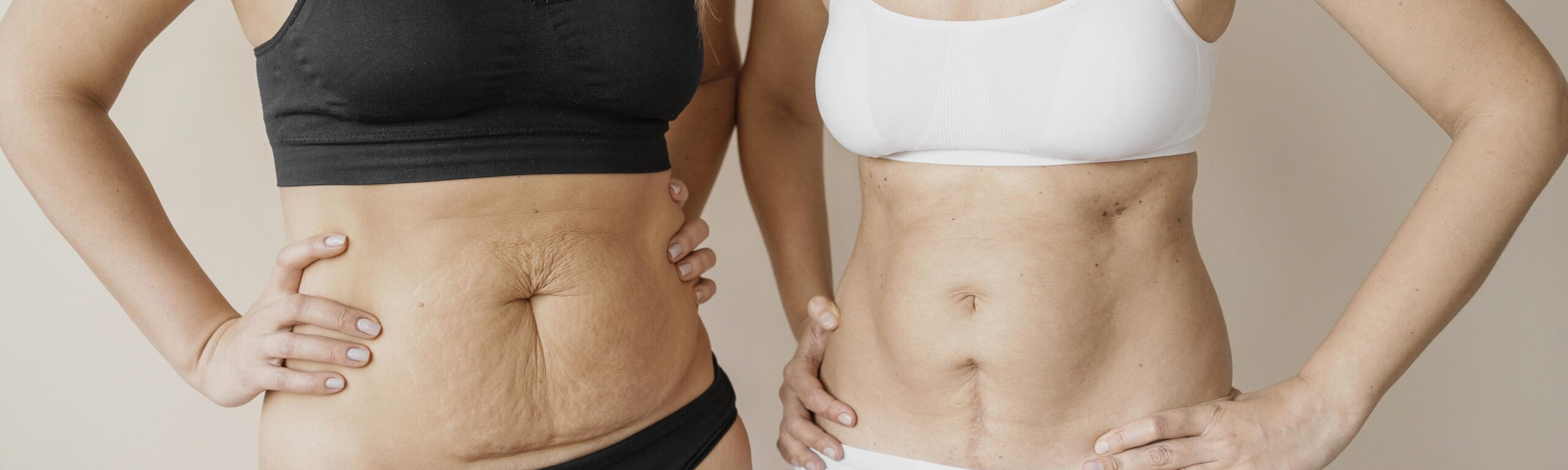 close-up-women-with-scars